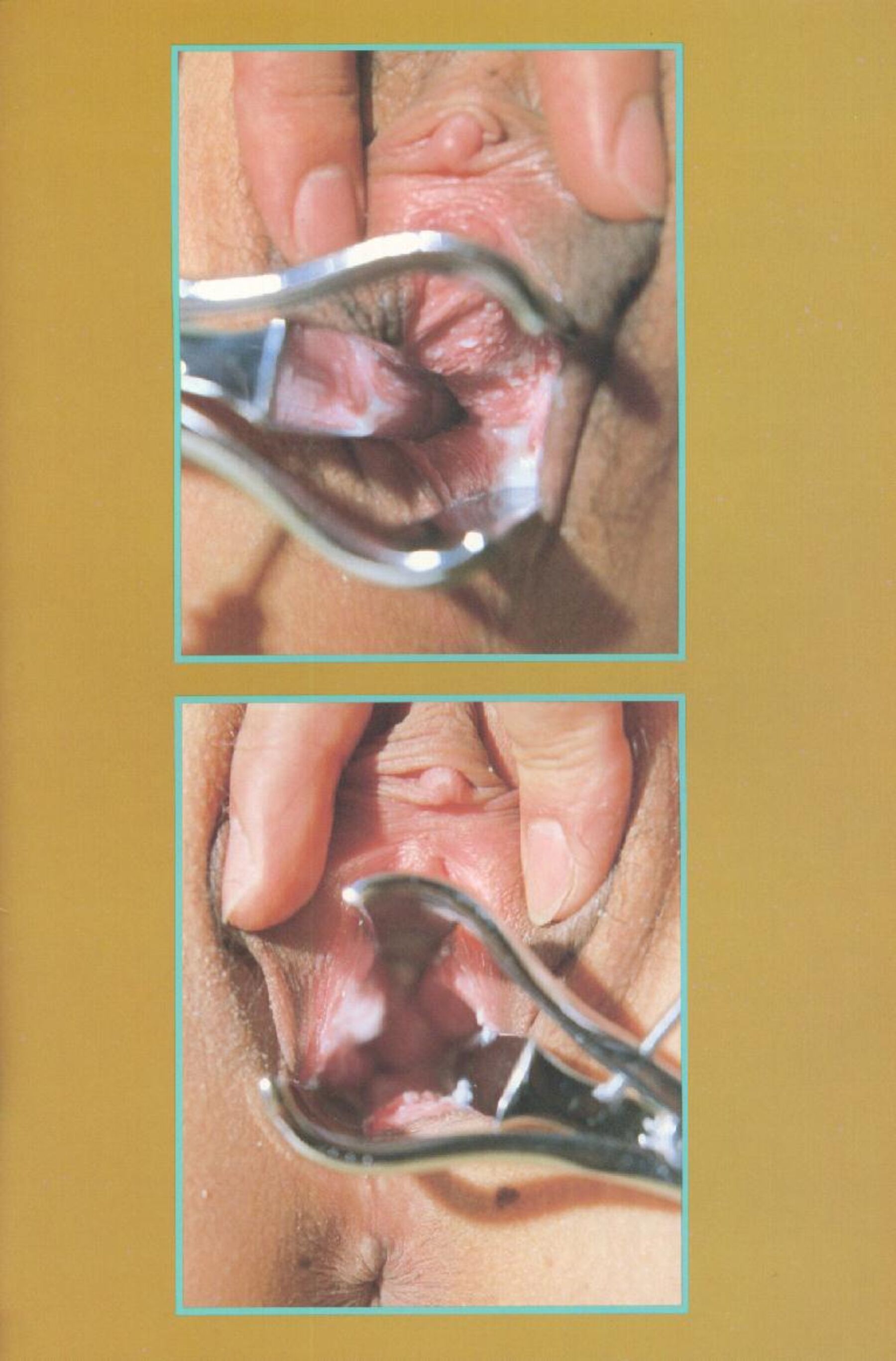 指くじり | Page 2